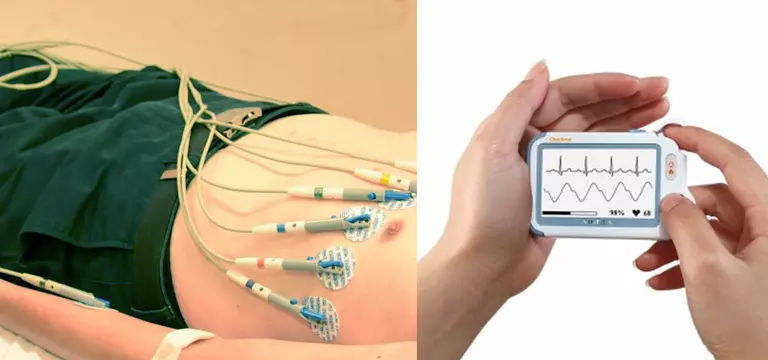 Make an Informed Decision: Understand the basics of ECG (Electrocardiogram) Test